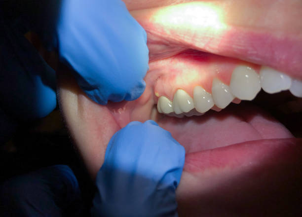 Best Emergency Cosmetic Dentistry in Nashville, NC