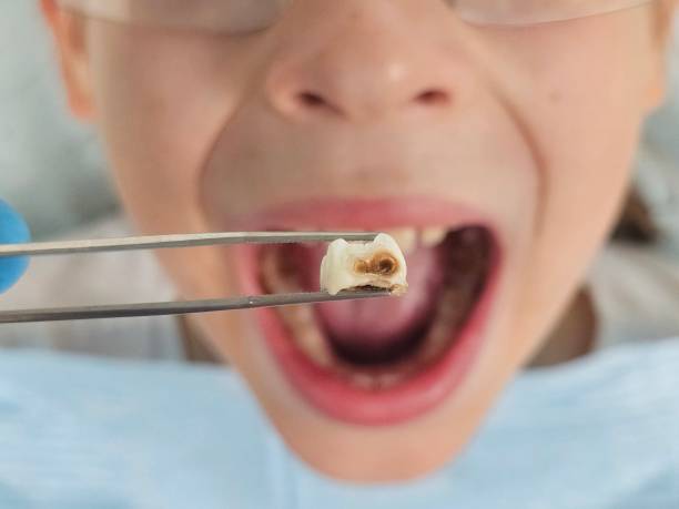 Best Holiday Emergency Dentist in Nashville, NC