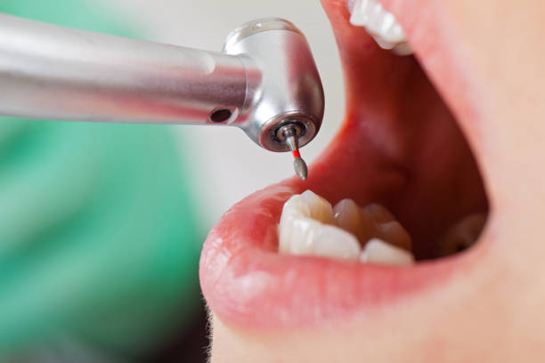 Best Orthodontic Emergency Dentist in Nashville, NC